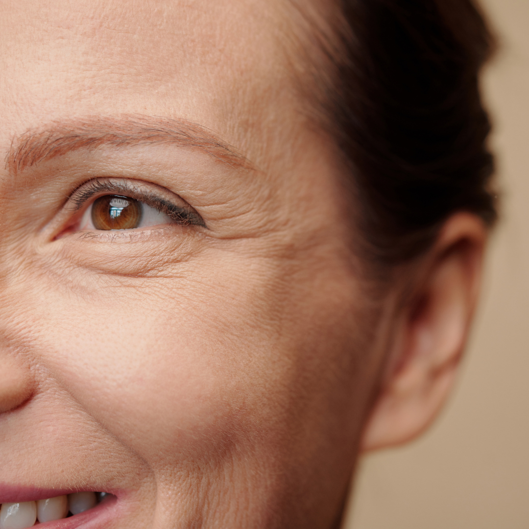 Fine Lines, Wrinkles & Aging Signs